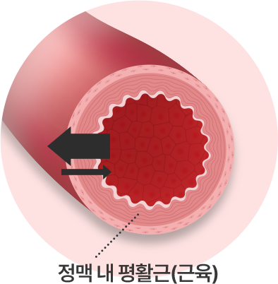 약해진 정맥긴장도